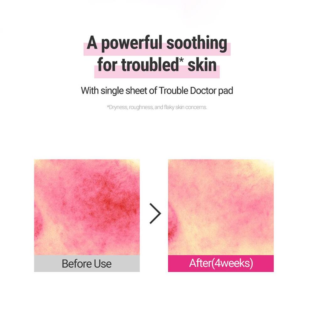 [ROVECTIN] Dr.Mask Cica Blemish Toner Pad 160ml 60EA