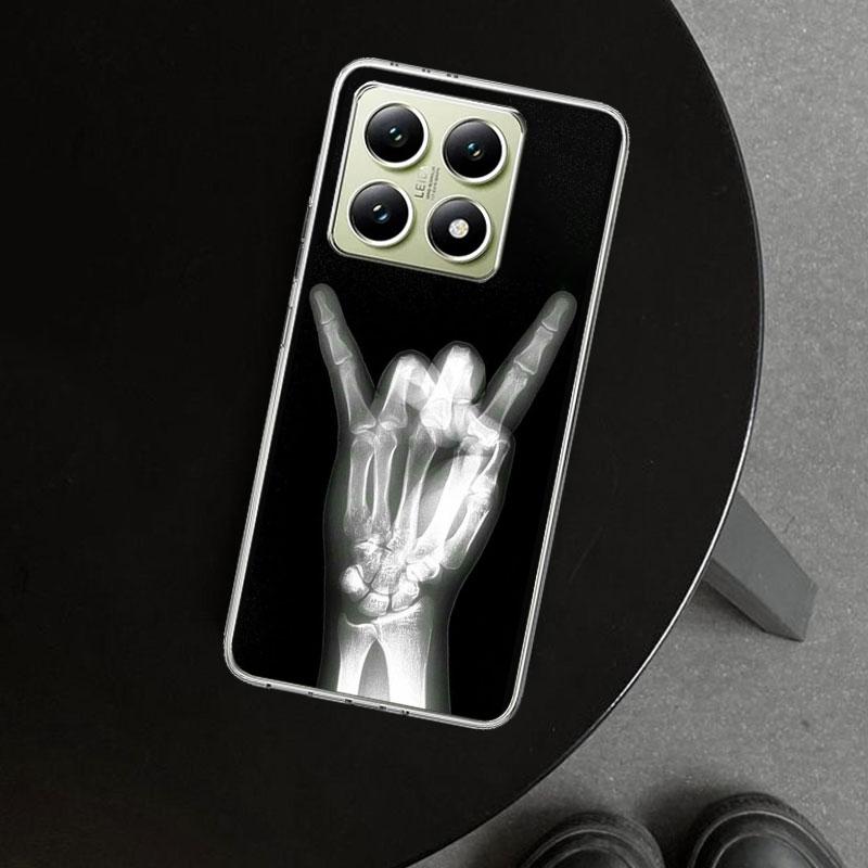 Autumu X Ray Hand Bones Phone Case Cover for Xiaomi Redmi Note 15 14 13 12 11 Pro Plus 14S 12S 11S 11T 11E 10S 10 Customized Fun