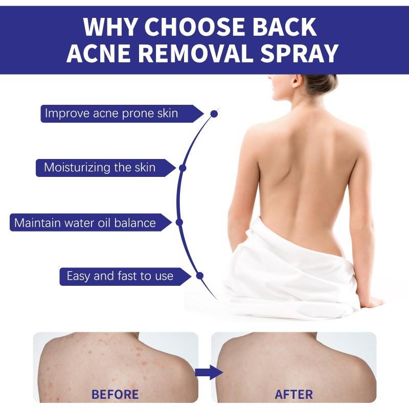 Jaysuing Back Care Spray For Fading Acne Marks And Smoothing Skin Texture