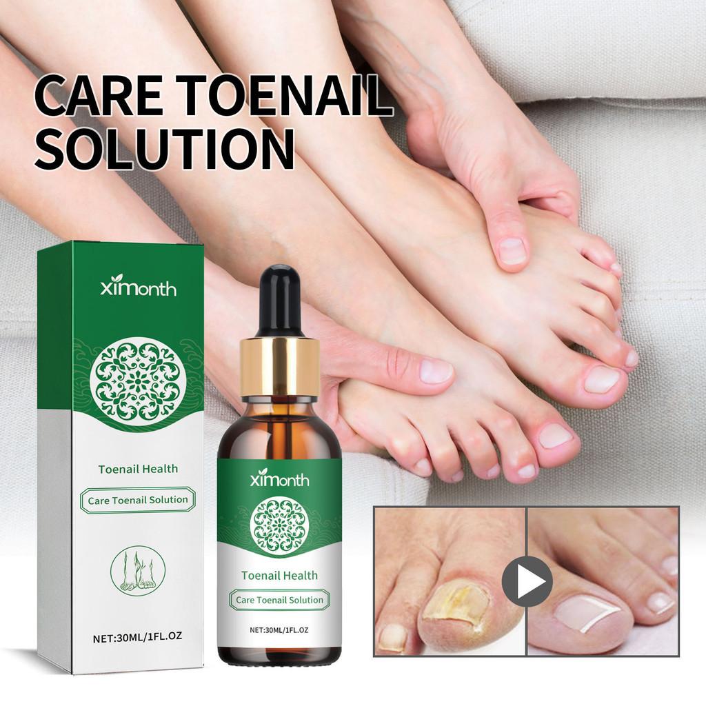 Ximonth Nourishing Toenail Care Liquid For Healthy Strong Nails And Beautiful Shine