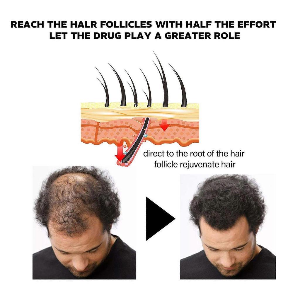 2025 Latest Model  Hair Growth Oil, Protect Hair Follicle Moisture Nutrition Hair Root Str