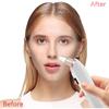 Electric Blackhead Vacuum Cleaner 4-Level Suction Modes Blackhead Removal Tool with Heating Mode