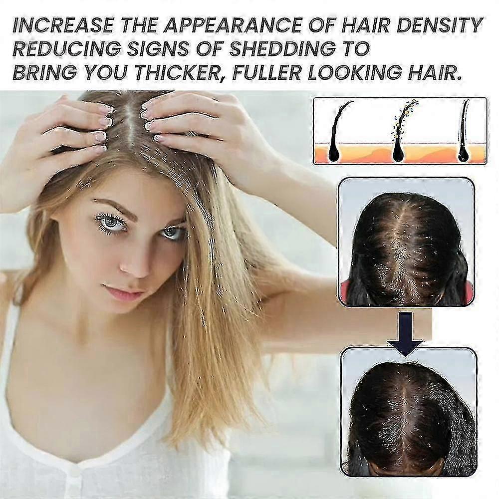 3pcs Ouhoe Hair Serum Biotin Hair Generating Essential Oil 3362223739905