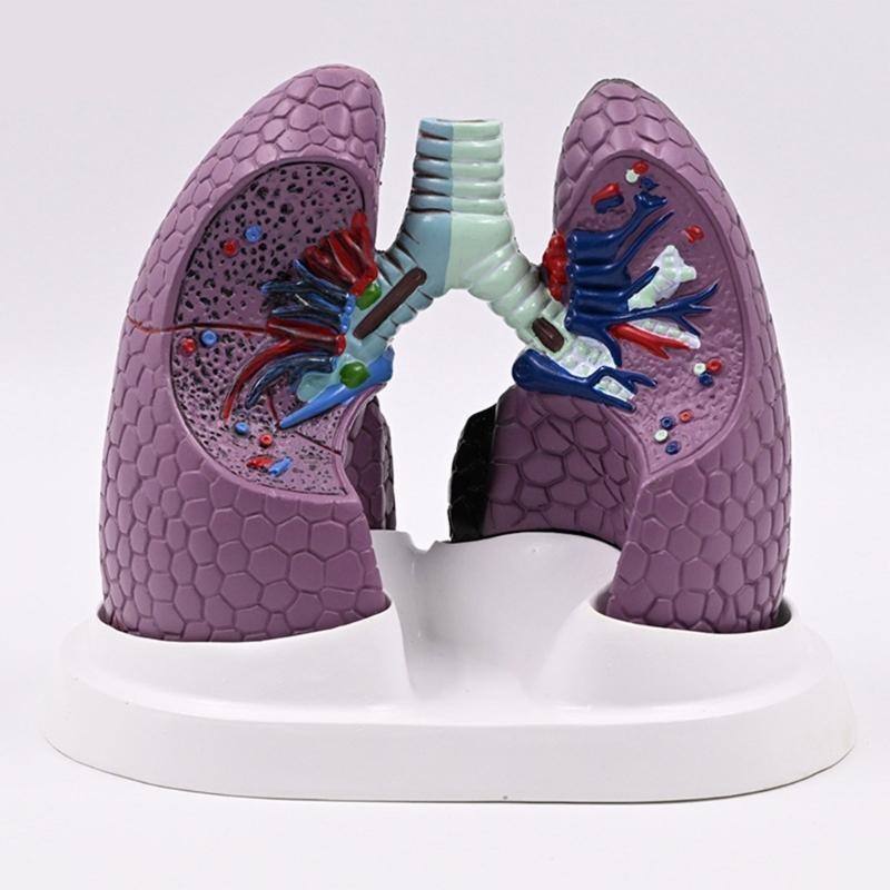 W89C Realistic Lung Anatomy Model Anatomical Human Lung Model Teaching Tool Normal and Pathological Lung Anatomy Model China Mainland