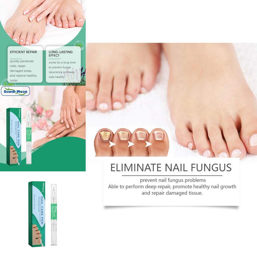 Sanfter Feuchtigkeitsspendender Nagelreparaturstift Für Dicke Und Weiche Nägel Behandlung 4ml