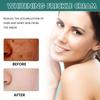 EELHOE Nicotinamid-Sommersprossencreme, feuchtigkeitsspendende Gesichtsaufhellungsreparatur, Hautpflege, Melasma-Entferner, Pigmententfernungscreme, 30 g