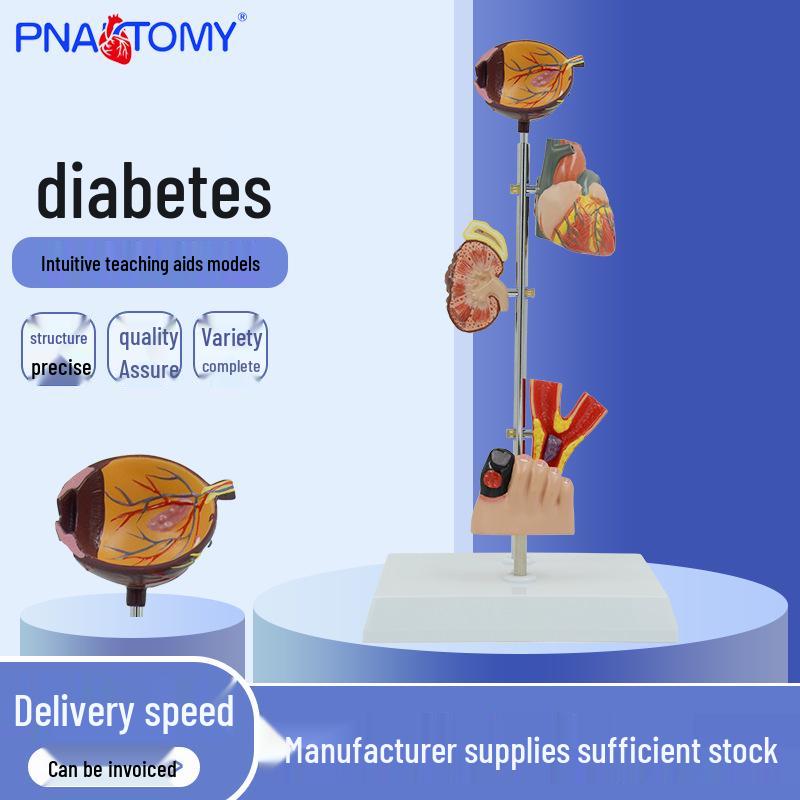 Human Diabetes Complications Model: Eyes, Heart, Kidneys, Blood Vessels, Foot, Orthopedics, Rehabilitation, Pathology PVC Material