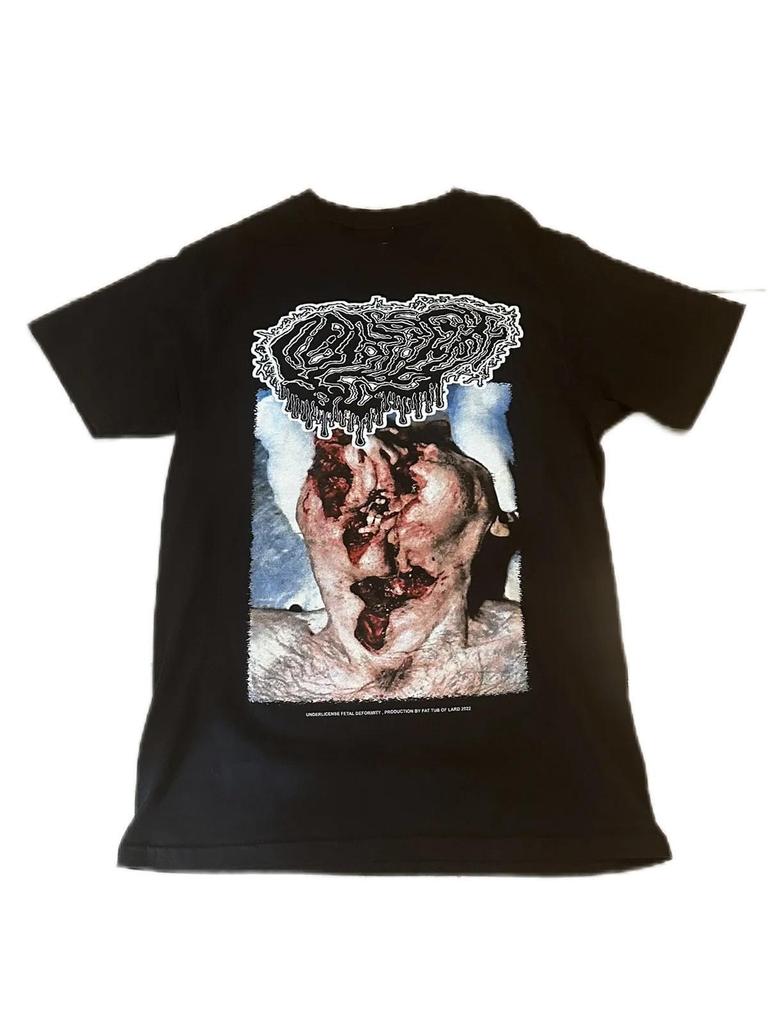 Undeath Fetal Deformity T-Shirt
