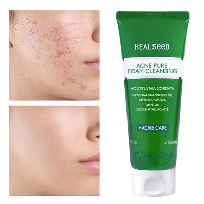 Yakmomil Healseed Acne Pure Foam Cleansing 150ml Shipped from Head Office, 1 Unit