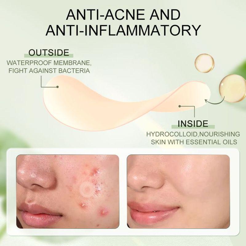 Sace Lady - Acne Patch