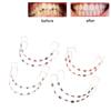 1 Paar Bunte Temporäre Zahndekoration Mit Metalldrähten Metallbrackets Und Kieferorthopädischen Ligaturen Dentaldekorationen