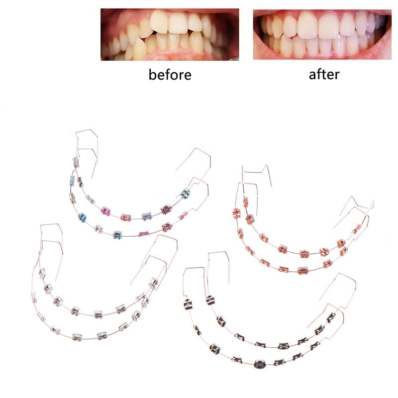 1 Paar Bunte Temporäre Zahndekoration Mit Metalldrähten Metallbrackets Und Kieferorthopädischen Ligaturen Dentaldekorationen
