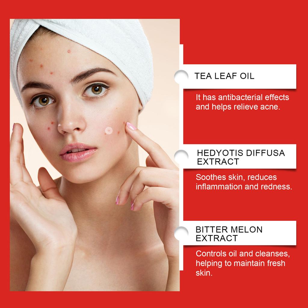 Jaysuing Acne Cover Patches For Face Skin Soothing Healing And Pimple Relief With 288 Durable Patches