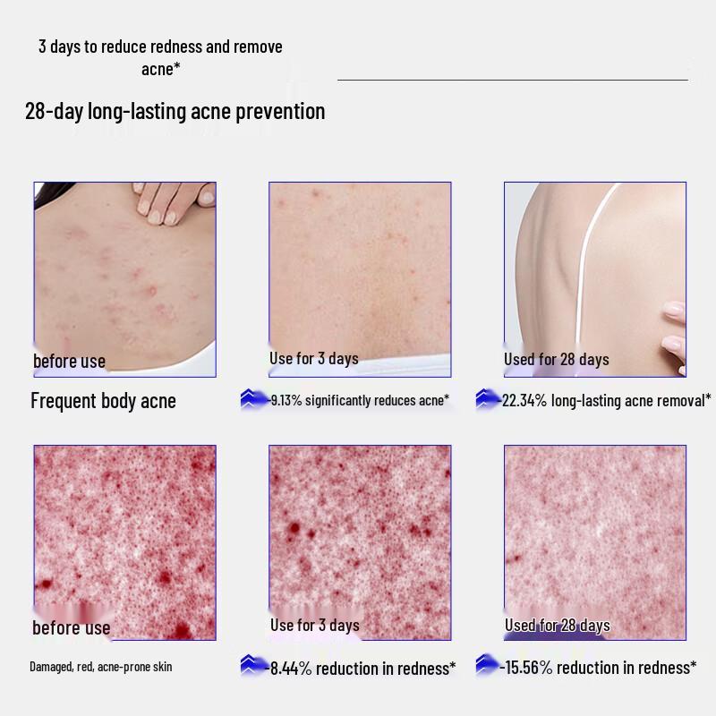 EHD Salicylic Acid Acne-Removing Fragrance Shower Gel