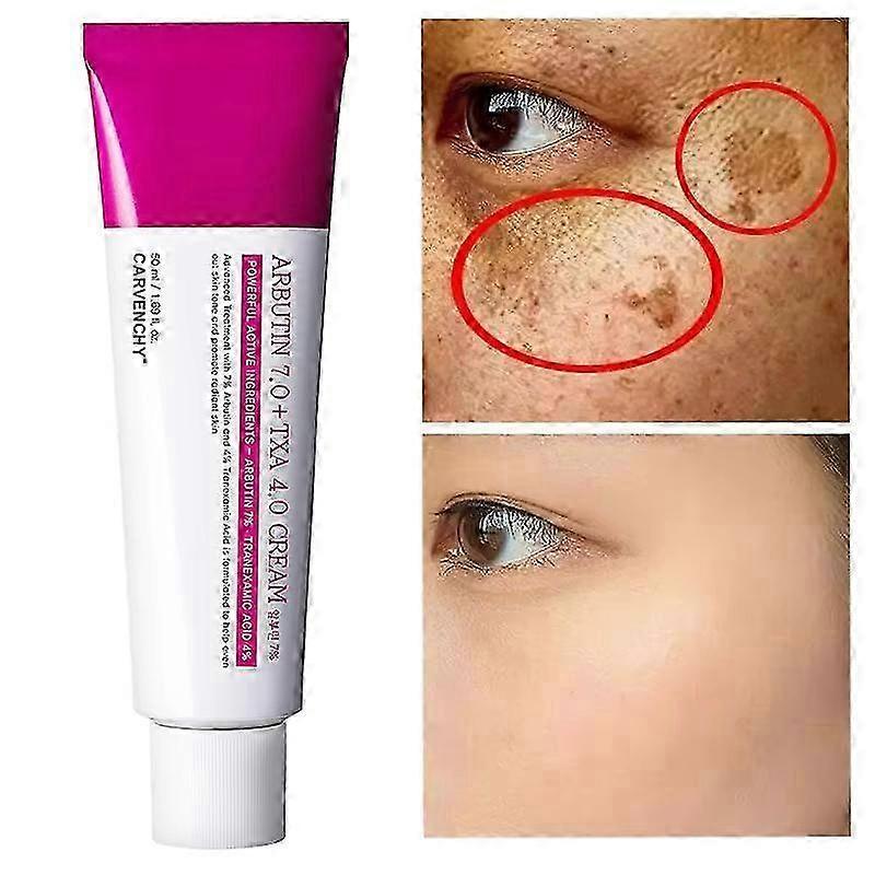 1-5x Arbutin 7% Tranexamic Acid 4% Cream 50ml Brightening K-beauty