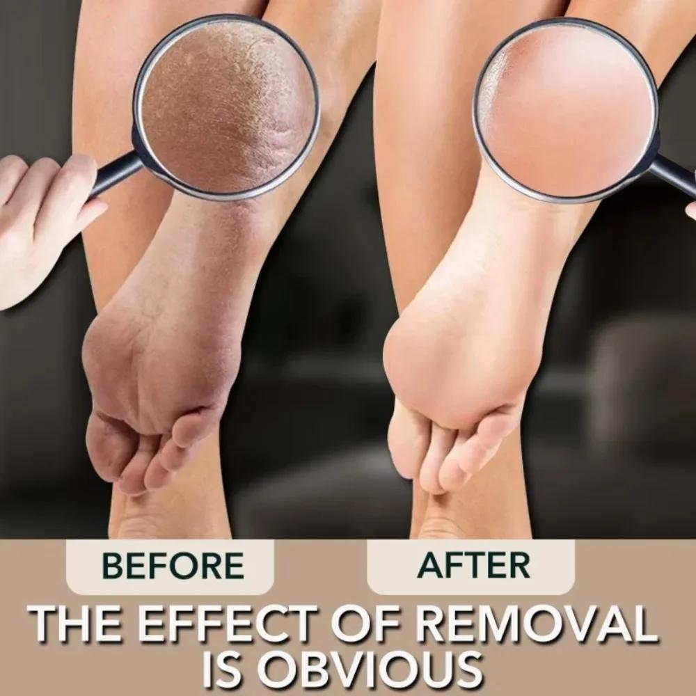 Nano Glass Double-sided Foot Rasp Heel File Hard Dead Skin Callus Remover Exfoliating Pedicure Care Foot File Beauty Tools