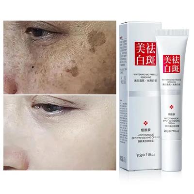 Effektive Creme zum Aufhellen von Sommersprossen, zum Aufhellen des Gesichts, zum Entfernen dunkler Flecken im Gesicht, Melasma, Anti-Pigmentierung, zur Verbesserung der Mattheit, Hautpflegecreme