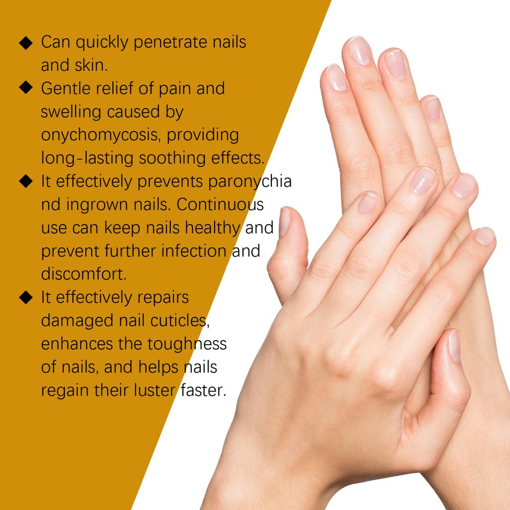 Pflegendes Nagelpflegeöl für gesündere, stärkere Finger- und Zehennägel 30ml