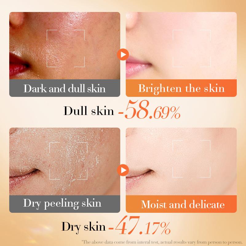 Astaxanthin Antioxidant Creme, Aufhellende Feuchtigkeitsspendende Haut Schönheitscreme Hautpflegeprodukte