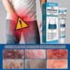 Anti-bacterial Cream Men's Anti-itch Cream Intimate Care_c*