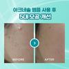    Atte [trouble Ampoule Sebum Care] Ate Acnesol Programming Ampoule Single Duo Planning Ampoule Single