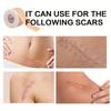 Self-Adhesive Scar Treatment Tape Easy-Tear Scar Care Patches Easy-to-Use Skin Cover Tape  Keloids