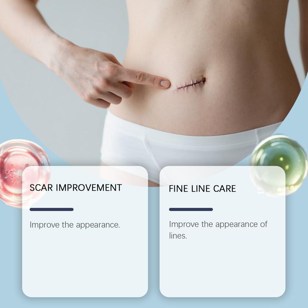 Gentle Skin Gel Body Skin Smooth, Soft and Refreshing Scar Repair Texture Comfortable Daily Care Gel