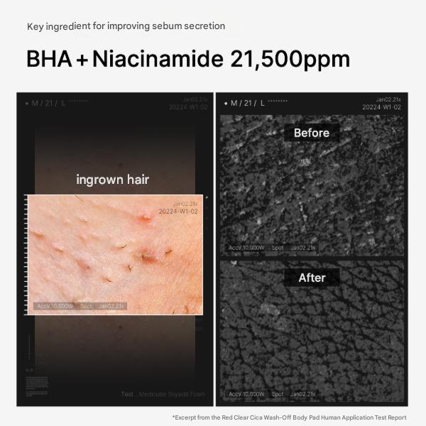 Medicube Red Clear Cica Wash-Off Body Pad 50 Pads (200ml) (3 Options)