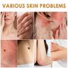Skin Care Cream Gently Cleanses And Nevus Moisturizing And Soothing Skin Care Cream