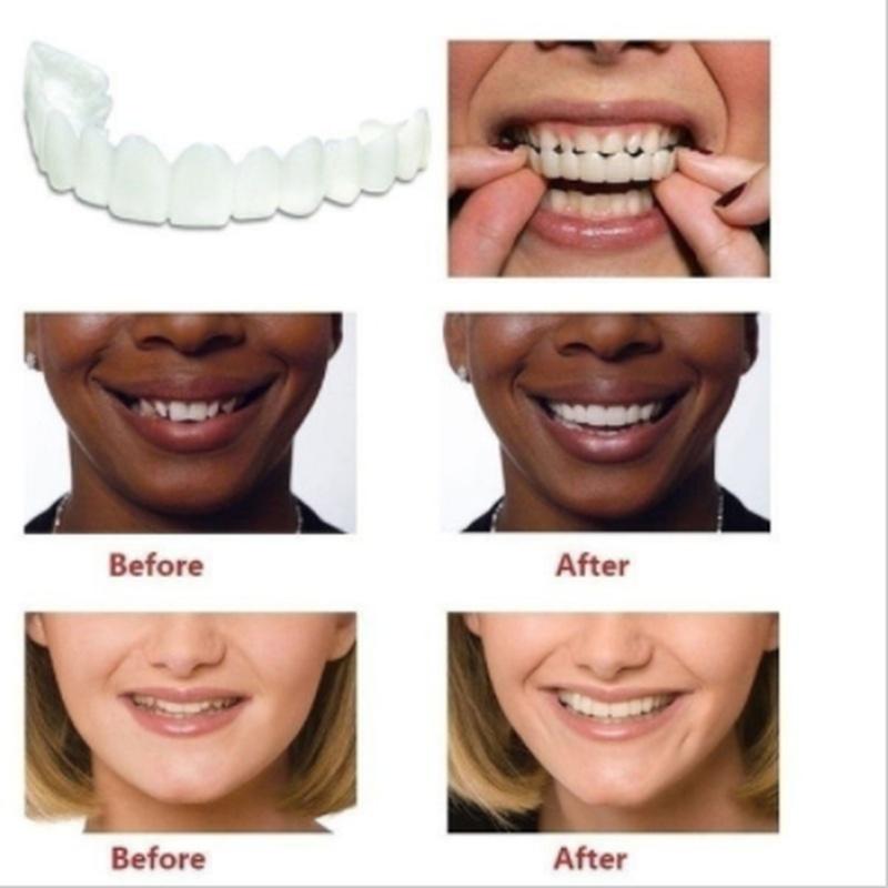 Buy 2Pcs Reusable Adult Snap On Perfect Smile Whitening Denture Fit