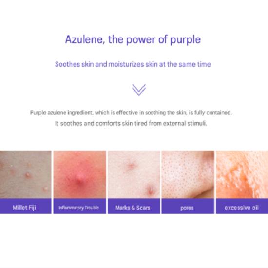 Acnes Treatment Acnes Treatment Real AC Control Swap 100 Sheets 1 Piece