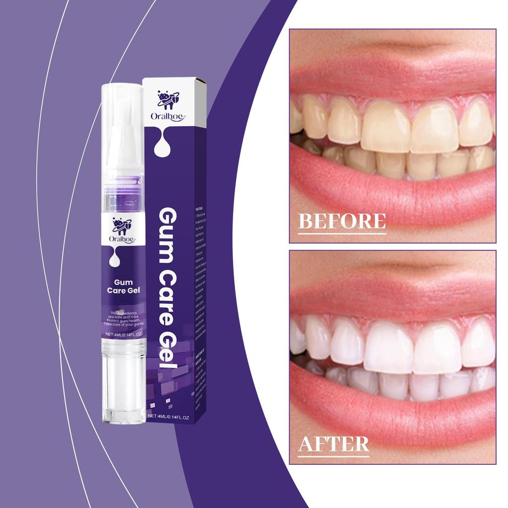 Siero Riparazione Rapida Gengive Viola Gel Cura Gengive Danneggiate Allevia Efficacemente Allergie Dentali Carie Dentale Pulizia Profonda Denti Dentifricio