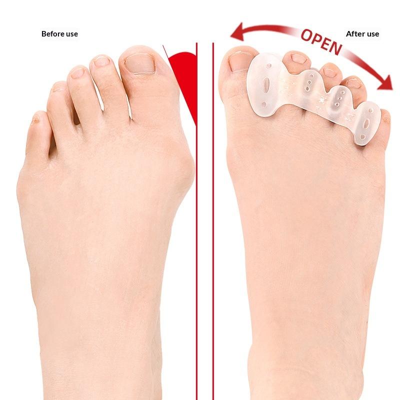 1 Paar Zehenspreizer mit Löchern korrigieren Fuß- und Hallux-valgus-Schmerzen, Plantarfasziitis und verbessern die funktionelle Beweglichkeit.