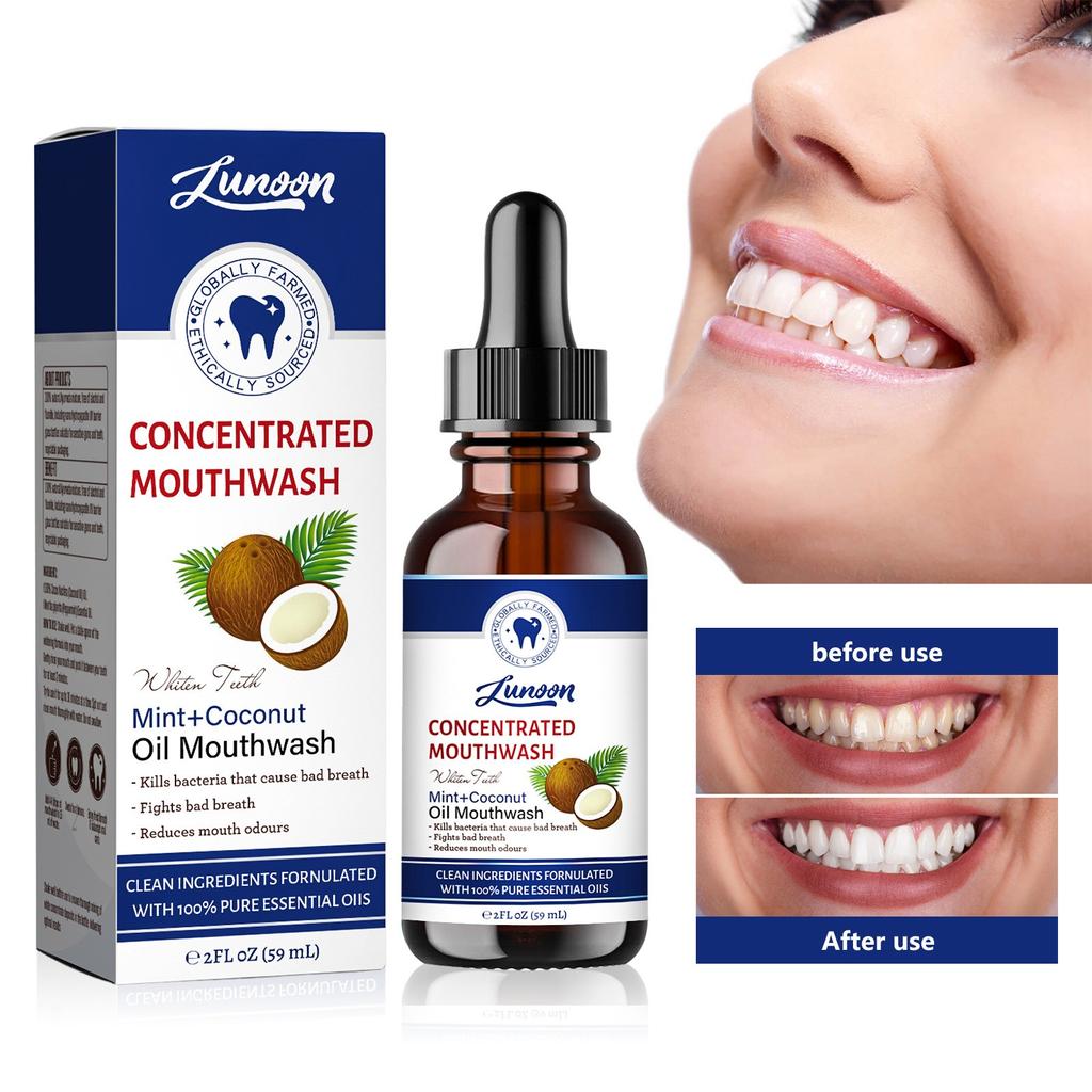 Mouthwash For Removing Oral Odors Stains, Cleaning Teeth Whitening Care Daily Mouthwash To Odor Mouthwash 59ML