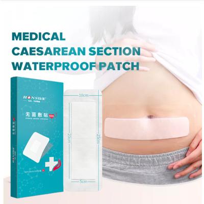 Waterproof Medical Sterile Wound Dressing Patch Caesarean Section Patch Sterile Sticker