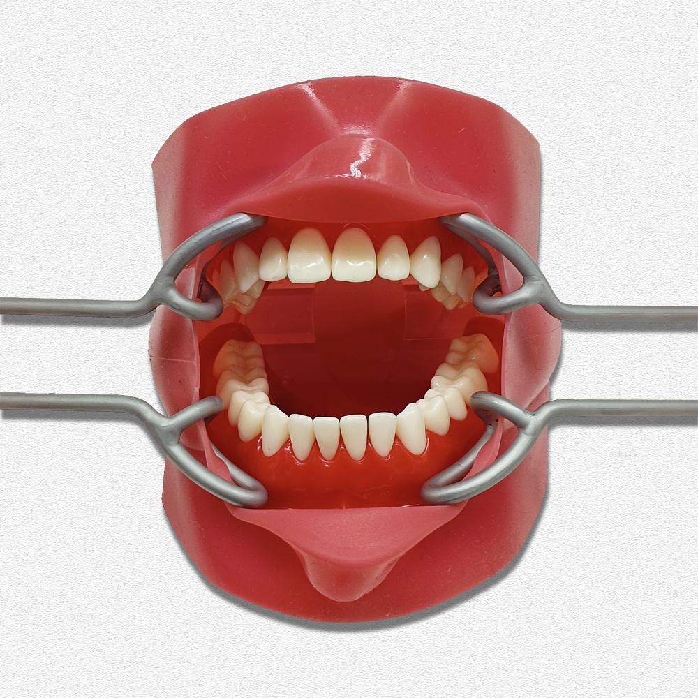 Upgrade Dental Orthodontic T Shape Vestibulum Retractor Lip Cheek Retractor Mouth Gag Opener Mouth Retractor Double Ends