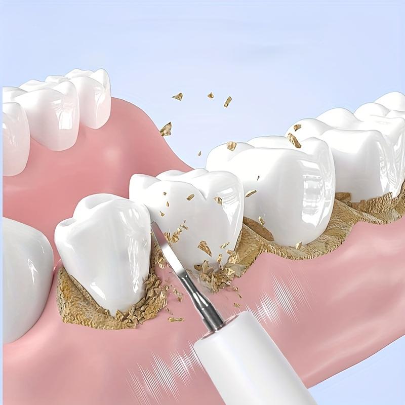 Ultrasonic Dental Scaler for Teeth Cleaning, Tartar Plaque Remover, Portable Home Oral Care Device