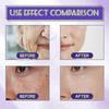 B3 Serum, Dark Spot Corrector B3 Serum With Anti-Aging 10% Niacinamide Discoloration Correcting Serum for Sun Spots, Age Spots
