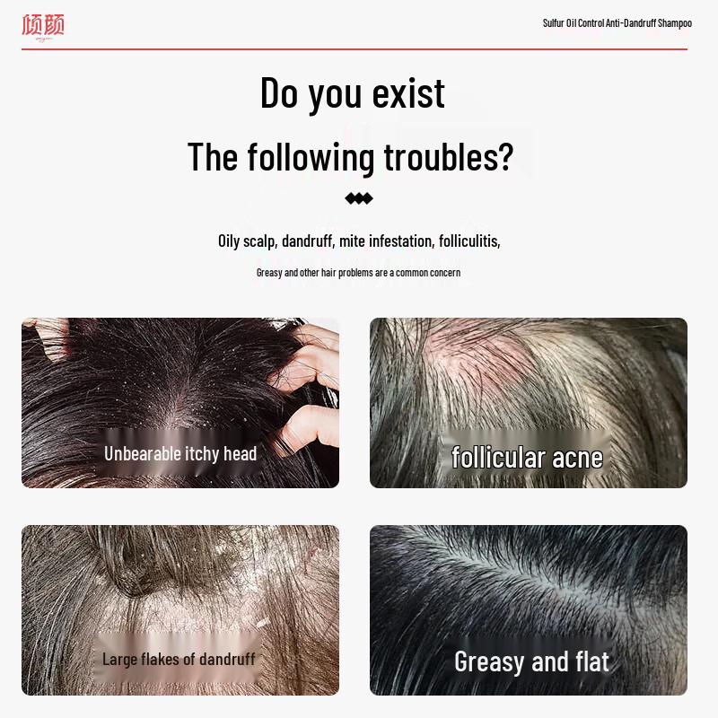 QINGYAN Sulfur Anti-Dandruff & Oil Control Shampoo