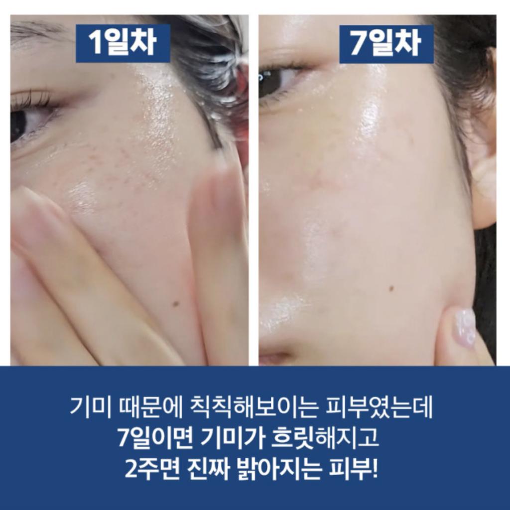 [HUECALM] Niacin Vita Snow Serum 30ml