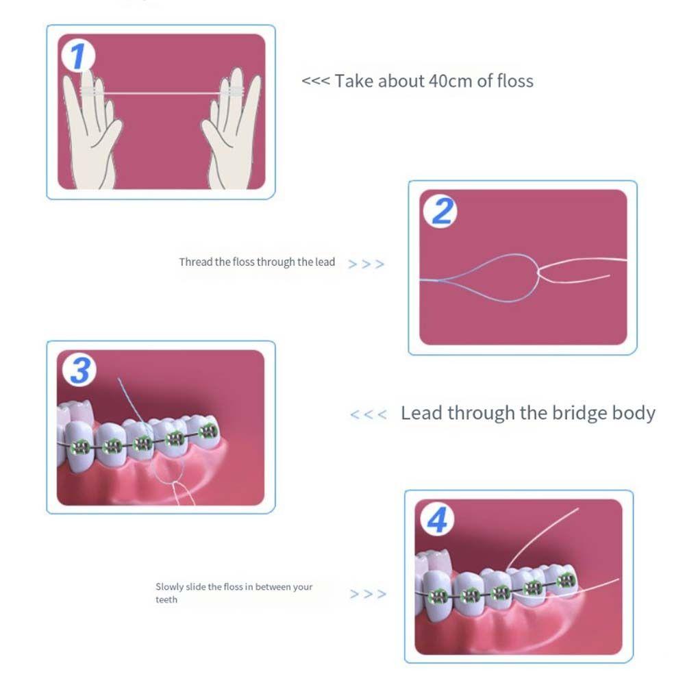 Orthodontic Dental Floss Threaders Dental Traction Line for 70Pcs for Braces Bridge Implant