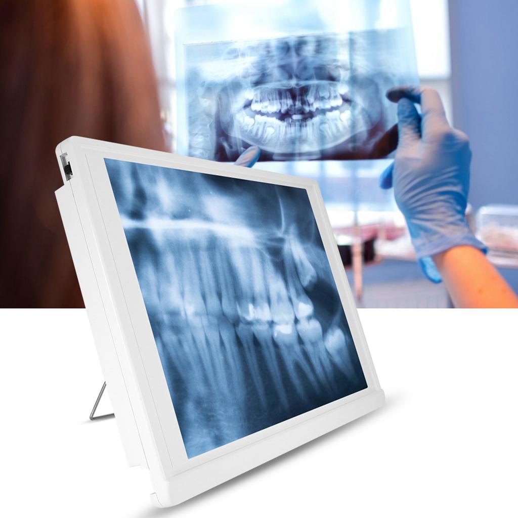 AC110- Przeglądarka zdjęć dentystycznych Podświetlarka LED z uchwytem Klips do mocowania zdjęć