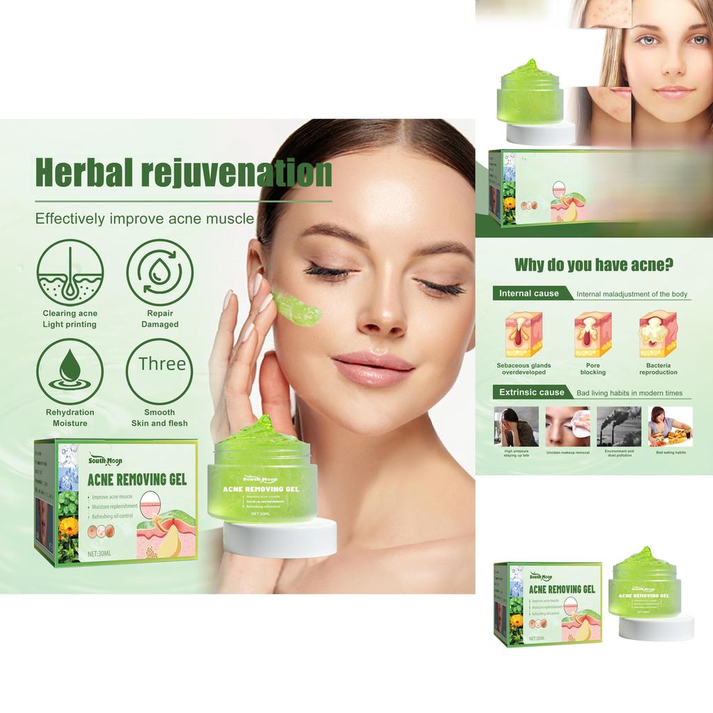 South Moon Acne Gel For Clear And Radiant Skin 30ml Blemish Reducing Formula