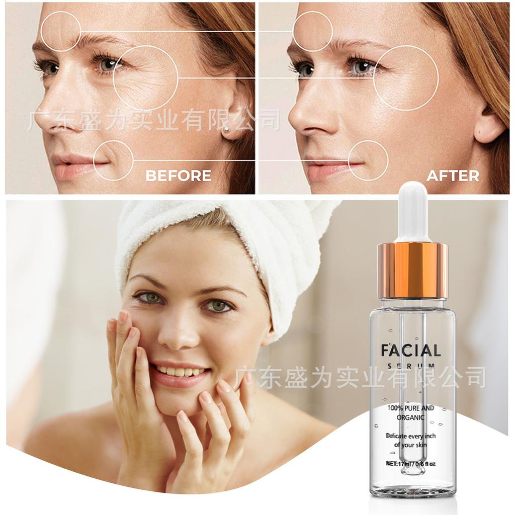 Vitamin C Serum 17ml – Anti-wrinkle, Brightening and Moisturising Facial Serum