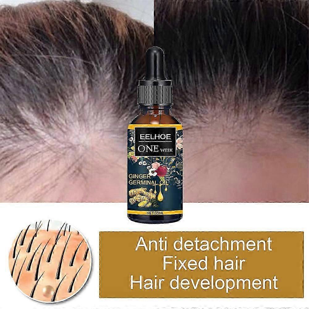Ginger Germinal Oil Plant Essential Oil Hair Nutrient Solution Hair Growth Essence Liquid