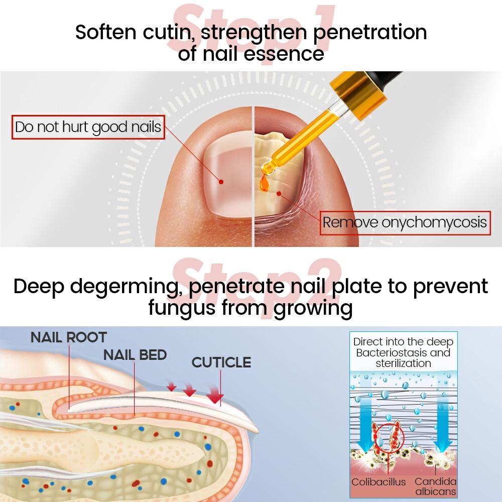 Výživa nehtů, čištění a hydratace, zklidňující hydratace, výživa nehtů, nehty tvrdé a lesklé