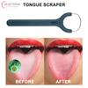 1Pcs Stainless Steel Tongue Scraper Fresh Breath Cleaning Coated Tongue Toothbrush Oral Hygiene Metal Scraper