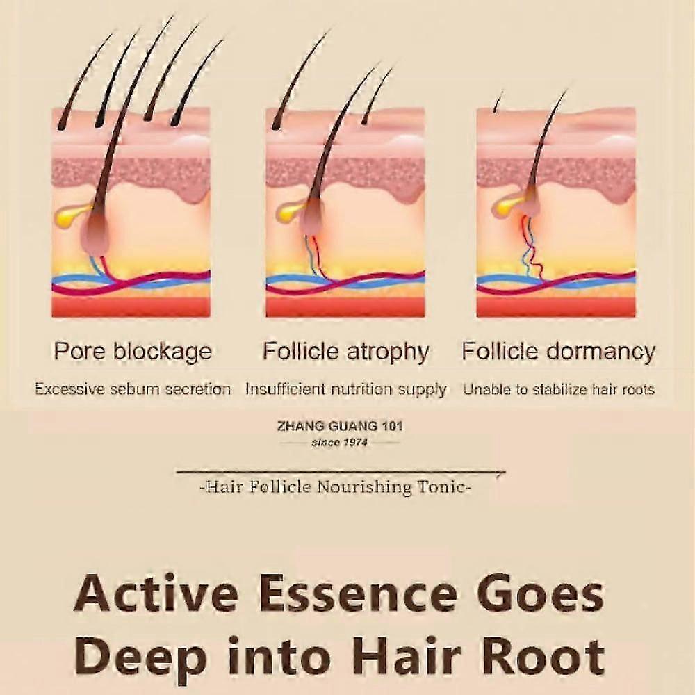 Zhangguang 101 Hair Follicle Nourishing Tonic + 101B, 2 Pieces In a Lot Anti Hair Loss Hair Regrowth Sets