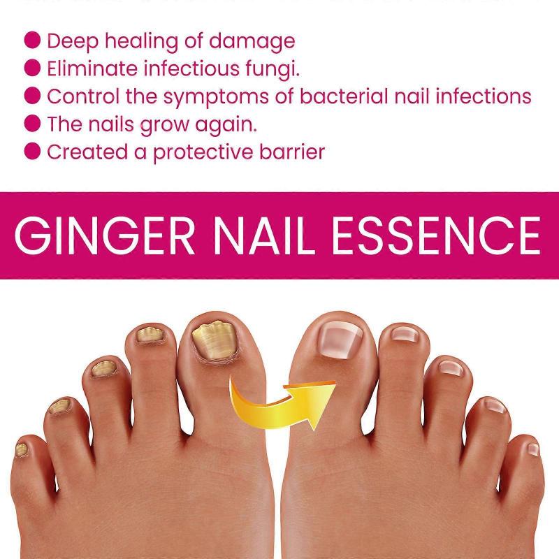 1-5x OUHOE Zázvorová esence pro péči o nehty, Šedá hydratační péče o nehty Exfoliační kosmetická esence pro nehty