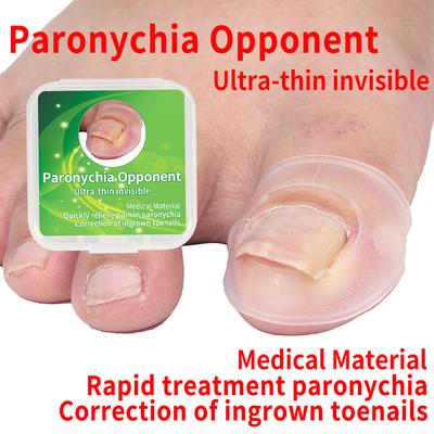2 SZT. Narzędzie do korekcji wrastającego paznokcia u stopy Osłonka na palec u nogi Ochraniacz na paznokieć u stopy Rękawy na duży palec u nogi Gruba zanokcica